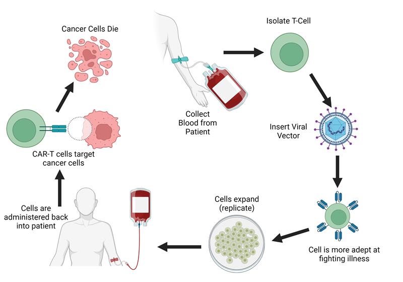 CAR-T Cell Therapy